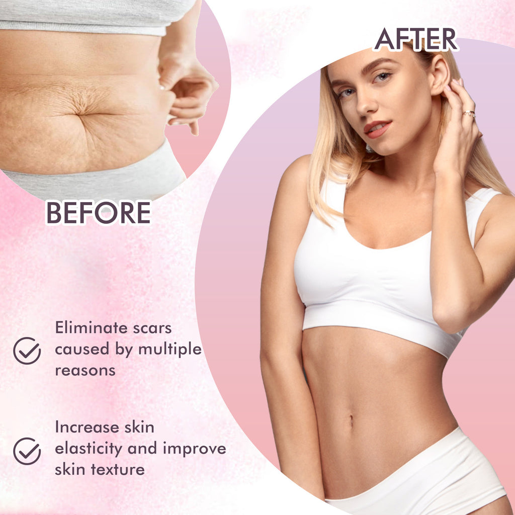 Skincare Body Oil Fade Scars