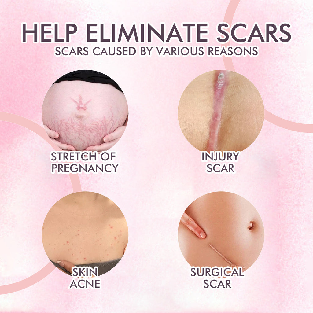 Skincare Body Oil Fade Scars